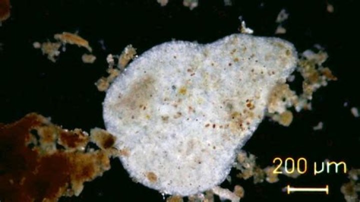 What does a pelomyxa do?